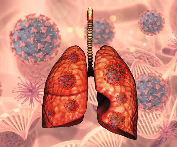 3D render of a medical background with lungs and Covid 19 virus cells
