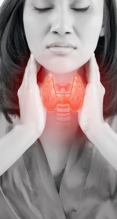 Illustration thyroid on the throat woman. isolated on white background.