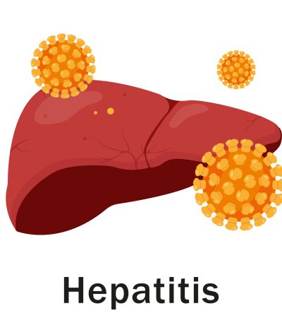 Human liver and Hepetitis virus on it. Viral hepatitis medical or education concept. Vector illustration isolated on white background.