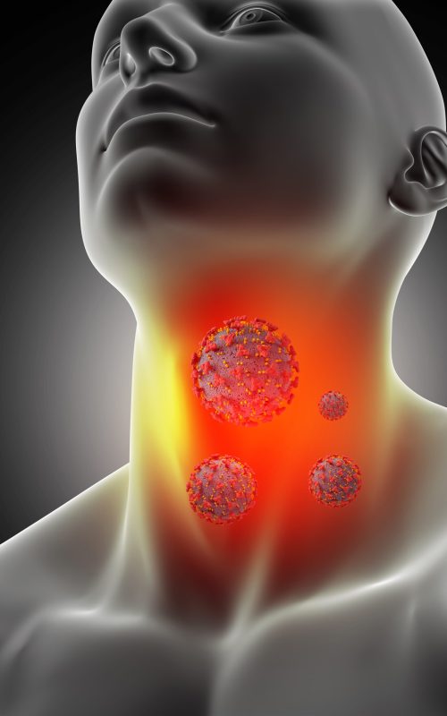 3D render of a male medical figure with sore throat and corona virus cells