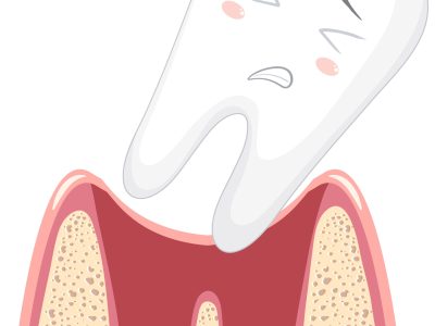 Cartoon loose teeth in gum on white background illustration