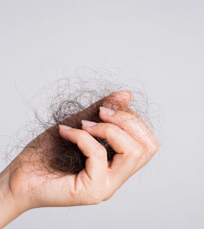 Woman hand holding hair loss on gray background. Health care and medical, Hair loss problem concept.