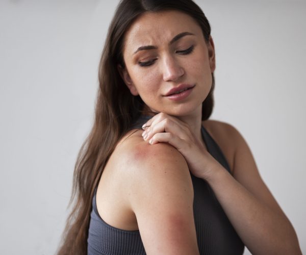 woman-suffering-from-rash
